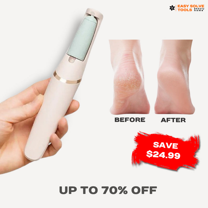 EasySolveTools™ Portable Foot Callus Remover